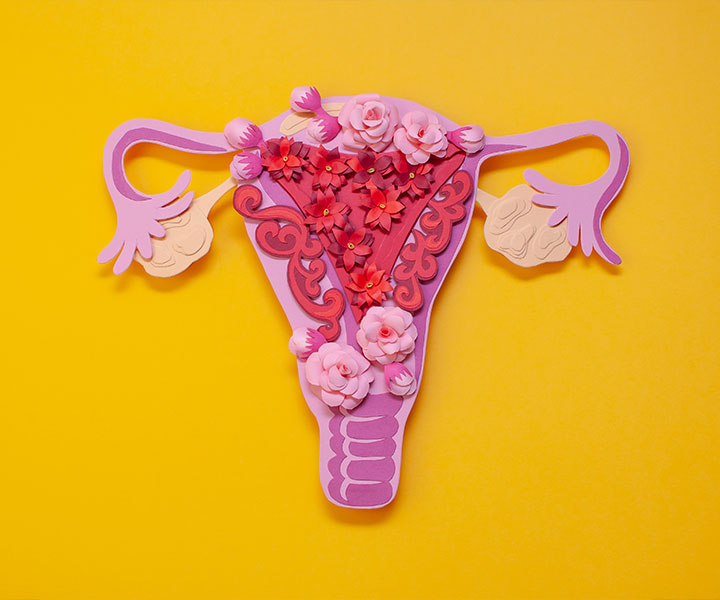 endometriose-article